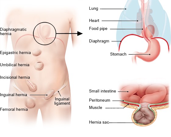 inguinal ligament in women